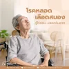 ความรู้เรื่องโรคหลอดเลือดในสมอง ความรู้เรื่องโรคหลอดเลือดในสมอง