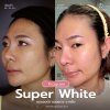 รีวิวโปรแกรม Super White
