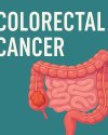 Colorectal Cancer and the Supportive Role of Herbal Medicine