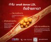 small dense LDL (sdLDL) small dense LDL (sdLDL)