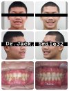️คุณหมอแจ็คเล่าเคส ️คุณหมอแจ็คเล่าเคส