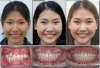 องค์ประกอบในรอยยิ้มที่สวย มันไม่ได้ประกอบไปด้วยฟันเพียงอย่างเดียว องค์ประกอบในรอยยิ้มที่สวย มันไม่ได้ประกอบไปด้วยฟันเพียงอย่างเดียว