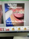 หมอแจ็คเล่าเคส หมอแจ็คเล่าเคส