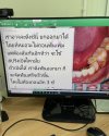 เล่าประสบการณ์ จัดฟันให้คนไข้ที่เป็นใบ้ เล่าประสบการณ์ จัดฟันให้คนไข้ที่เป็นใบ้