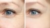 Eye Surgery Center