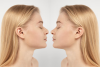 Nose Surgery Center﻿