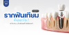 รากฟันเทียมคืออะไร รากฟันเทียมราคาเท่าไหร่
