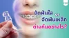 จัดฟันใส vs จัดฟันเหล็ก ต่างกันอย่างไร? เลือกแบบไหนดีให้คุ้ม