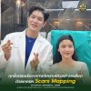 รีวิว รักษาหลุมสิว หมอหนูปอนด์