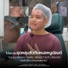 รีวิว รักษาหลุมสิว หมอหนูปอนด์