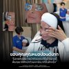 รีวิว รักษาหลุมสิว หมอหนูปอนด์