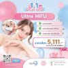 Ultra Hifu 1.1