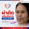 ผ่าตัดเปลี่ยนลิ้นหัวใจ คุณยายอายุ 69 ปี
