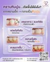 Tartar... how does it form even if you brush your teeth every day? Tartar... how does it form even if you brush your teeth every day?