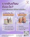 รากฟันเทียมคืออะไร เหมาะกับใคร รากฟันเทียมคืออะไร เหมาะกับใคร