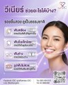 วีเนียร์ช่วยแก้ปัญหาอะไรได้บ้าง วีเนียร์ช่วยแก้ปัญหาอะไรได้บ้าง