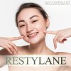 RESTYLANE