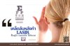 LASIK