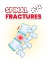 Spinal Fractures – Diagnosis, Treatment & Care at Chularat 3 Hospital Spinal Fractures – Diagnosis, Treatment & Care at Chularat 3 Hospital