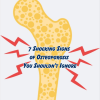 7 Shocking Signs of Osteoporosis You Shouldn’t Ignore 7 Shocking Signs of Osteoporosis You Shouldn’t Ignore