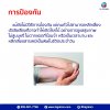 โรคนี้ชื่อ SLE หรือ ที่คนไทยมักเรียกว่า โรคพุ่มพวง