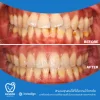 หลังจากได้รับการดูแล