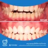 หลังจากได้รับการดูแล