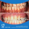 หลังจากได้รับการดูแล