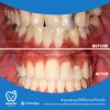 หลังจากได้รับการดูแล