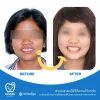 หลังจากได้รับการดูแล