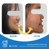 หลังจากได้รับการดูแล