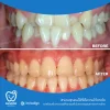หลังจากได้รับการดูแล