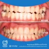 หลังจากได้รับการดูแล