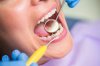 Does Dental Filling Hurt? A Complete Guide to the Procedure and How to Prepare Before Visiting the Dentist