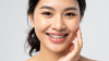 orthodontic step orthodontic step