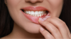 swollen gum