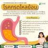 กรดไหลย้อน (Acid reflux (GERD))