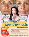 หลักสูตรเทคนิคนวดหน้ายกกระชับ แบบ ON-SITE