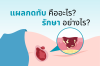แผลกดทับคืออะไร? รักษาอย่างไร? สาเหตุและวิธีป้องกัน ที่คุณต้องรู้ แผลกดทับคืออะไร? รักษาอย่างไร? สาเหตุและวิธีป้องกัน ที่คุณต้องรู้