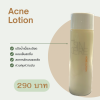 Acne Lotion