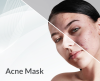 Acne Mask Acne Mask