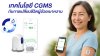 CGM