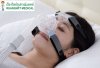 Nasal Mask Apex Wizard 210 (ครอบจมูก)