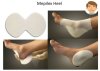 Mepilex Heel 13x20 cm สำหรับแผลที่ส้นเท้า