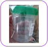 กระป๋องเก็บปัสสาวะสเตอไรด์ Urine Container Sterile (1 อัน)
