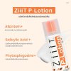 ZiiiT P-lotion ซิท พีโลชั่น แป้งน้ำทาสิว ดูแลสิวผด สิวผื่นทั้งใบหน้าและแผ่นหลัง
