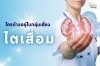 ใครบ้างที่อยู่ในกลุ่มเสี่ยงที่ไตจะเสื่อม !!!! ใครบ้างที่อยู่ในกลุ่มเสี่ยงที่ไตจะเสื่อม !!!!