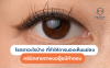 โรคตาอะไรบ้าง ที่ทำให้การมองเห็นแย่ลง คลินิกสายตามีคำตอบ