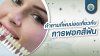 คำถามที่พบบ่อยเกี่ยวกับการฟอกสีฟัน คำถามที่พบบ่อยเกี่ยวกับการฟอกสีฟัน