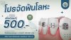 จัดฟันโลหะ จัดฟันโลหะ